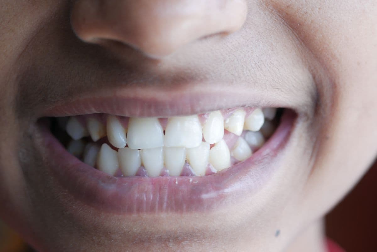 A close up view of a bright, natural smile with straight teeth